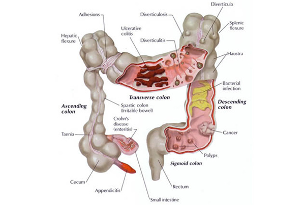 Col11